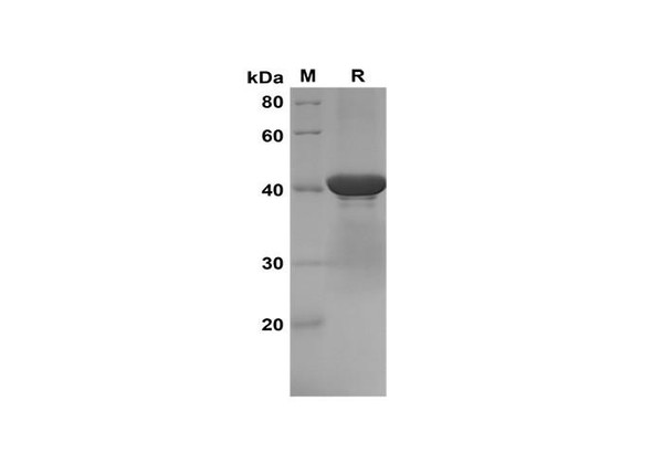 Recombinant Mouse Cystatin C Protein(Gst Tag) (RPES8180)