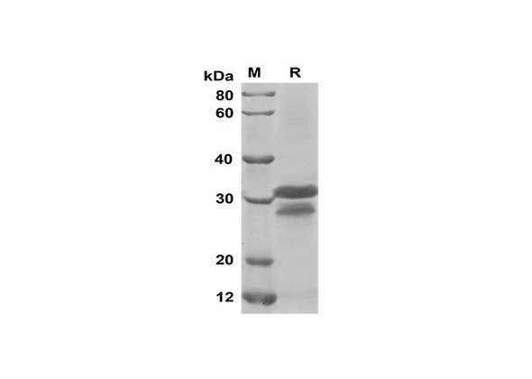 Recombinant Mouse CCL3/MIP-1Â± Protein(Trx Tag) (RPES8187)