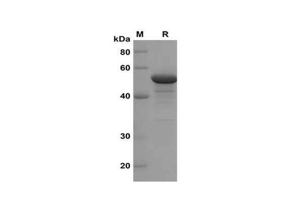 Recombinant Mouse DAO DAO1 Protein(Trx Tag) (RPES8205)