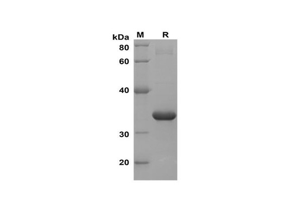 Recombinant Mouse IL-21 Protein(Trx Tag) (RPES8209)
