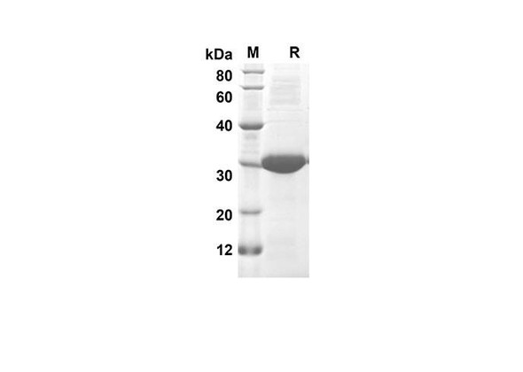 Recombinant Rat CXCL7 Protein(Trx Tag) (RPES8218)