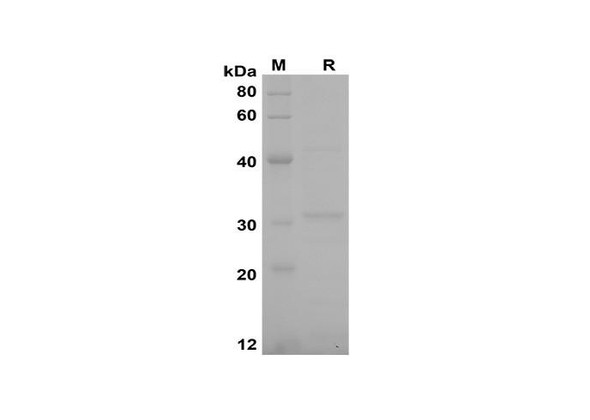 Recombinant Rat CCL20/MIP-3Â± Protein(Trx Tag) (RPES8246)