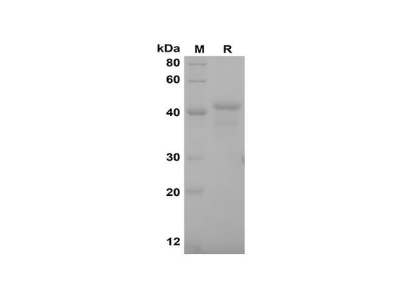 Recombinant Rat M-CSF Protein(Sumo Tag) (RPES8248)