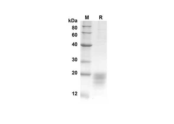 Recombinant Human IL5 Protein(His Tag) (RPES8260)
