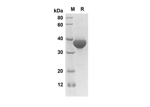 Recombinant Human EGF Protein(Fc Tag) (RPES8267)