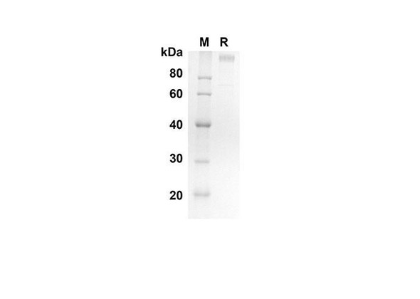 Recombinant Human ICAM5 Protein(His Tag) (RPES8281)