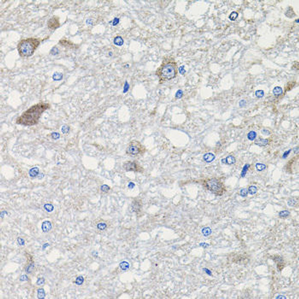 Anti-CDH23 Antibody (CAB2785)