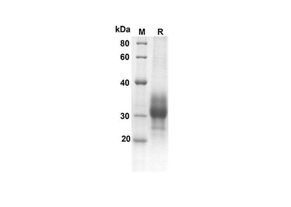 Recombinant Human TNFRSF9 Protein (His Tag) (RPES8301)