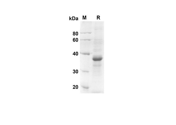 Recombinant human CCL3 Protein (Fc Tag) (RPES8314)
