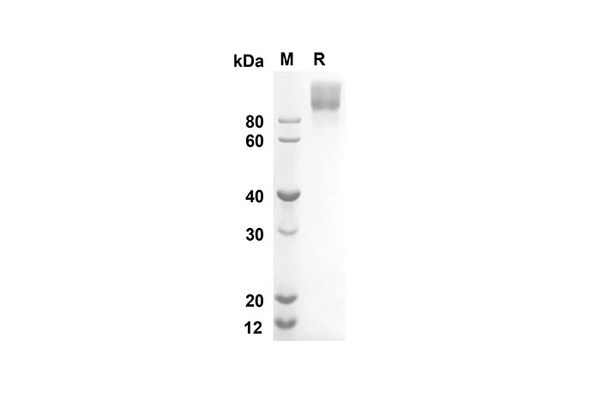 Recombinant Human KIT/SCFR Protein (Fc Tag) (RPES8320)