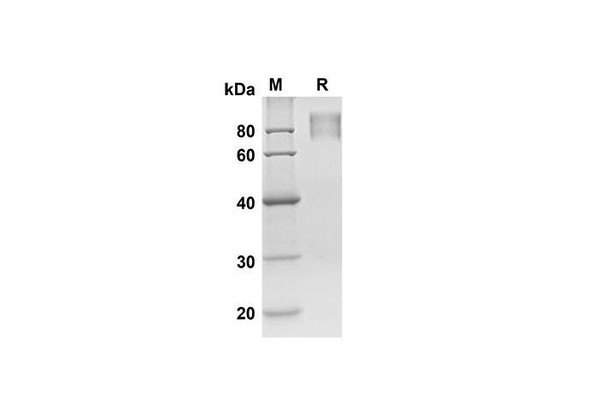 Recombinant Human KIT/SCFR Protein ( His Tag) (RPES8326)