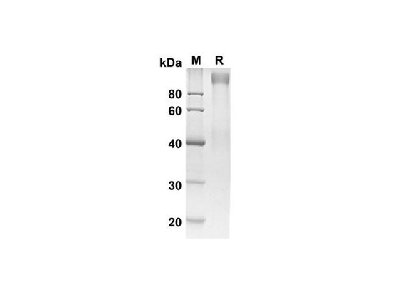 Recombinant Human ADGRE5 Protein ( Fc Tag) (RPES8327)