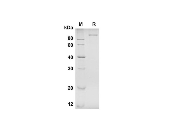 Recombinant Human Tie-2 Protein (His Tag) (RPES8333)