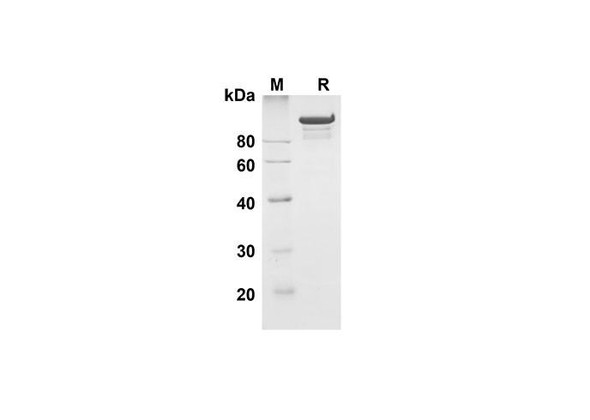 Recombinant Human MMP-9 Protein (Fc Tag) (RPES8338)