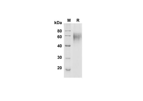 Recombinant Human DR6/TNFRSF21 Protein (His Tag) (RPES8341)