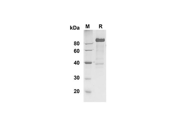 Recombinant Human DLL4 Protein (Fc Tag) (RPES8346)