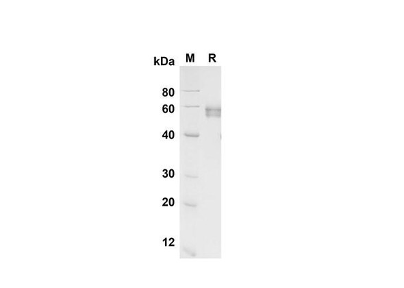 Recombinant Human EpCAM/TROP-1 Protein (Fc Tag) (RPES8356)
