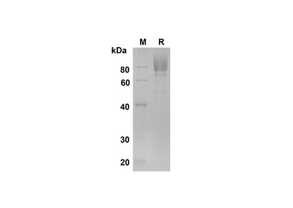 Recombinant Human M-CSF R/CD115 Protein (His Tag) (RPES8361)
