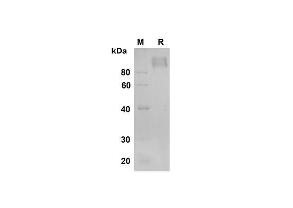 Recombinant Human M-CSF R/CD115 Protein (Fc Tag) (RPES8362)