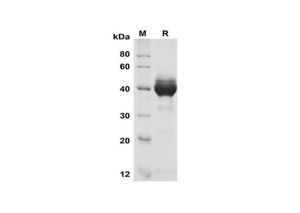 Recombinant Human GITR Ligand/TNFSF18 Protein (Fc Tag) (RPES8377)