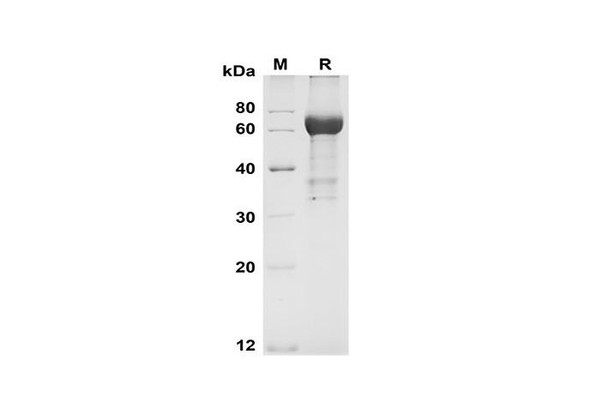 Recombinant Human SEPP1 Protein (Fc Tag) (RPES8379)