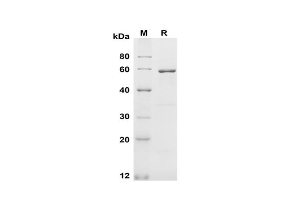 Recombinant Human Kallikrein 3/PSA Protein (Fc Tag) (RPES8384)