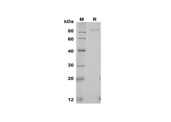 Recombinant Human Fibroblast Activation Protein Â±/FAP Protein (His Tag) (RPES8385)