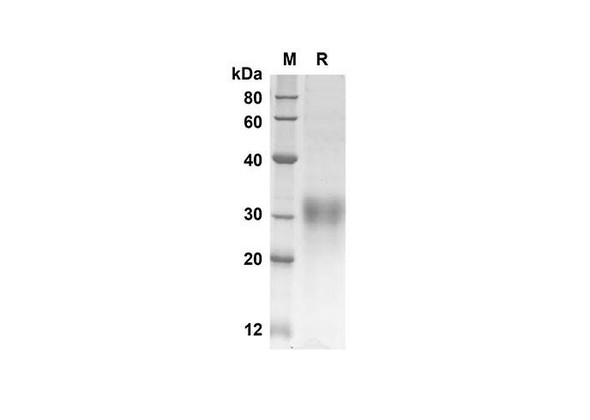Recombinant Mouse Igfbp6 Protein (His Tag) (RPES8397)