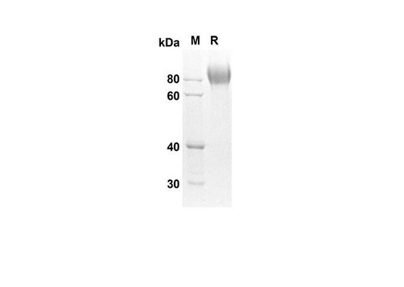 Recombinant Mouse Kit Protein (His Tag) (RPES8417)