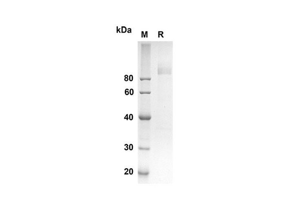 Recombinant Mouse CD36 Protein (Fc Tag) (RPES8421)