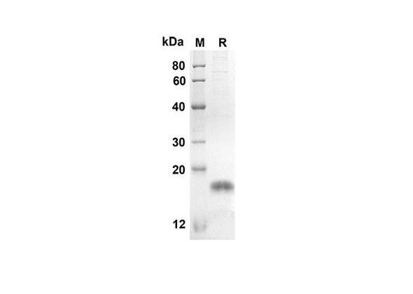 Recombinant Mouse TNFSF18 Protein (His Tag) (RPES8424)