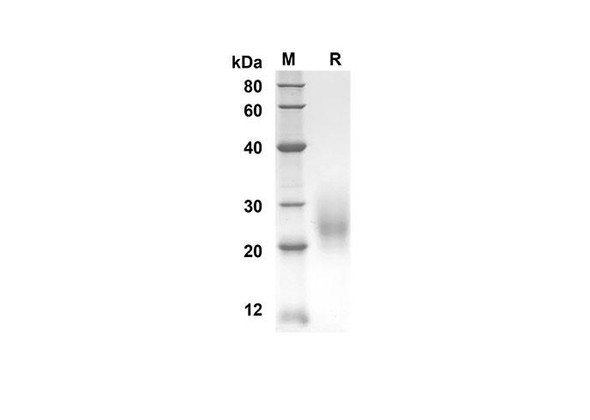 Recombinant Mouse Ctla4 Protein (His Tag) (RPES8437)