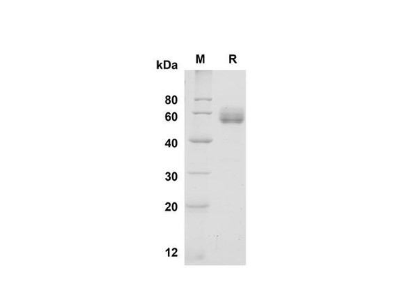 Recombinant Mouse Folate Binding protein/FBP Protein (Fc Tag) (RPES8449)