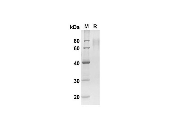 Recombinant Mouse CD6 Protein ( His Tag) (RPES8451)
