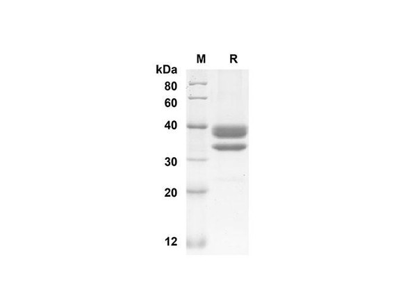 Recombinant Mouse CCL1 Protein ( Fc Tag) (RPES8456)