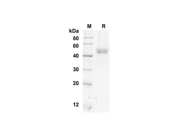 Recombinant Mouse NRG-1 Protein (His Tag) (RPES8457)