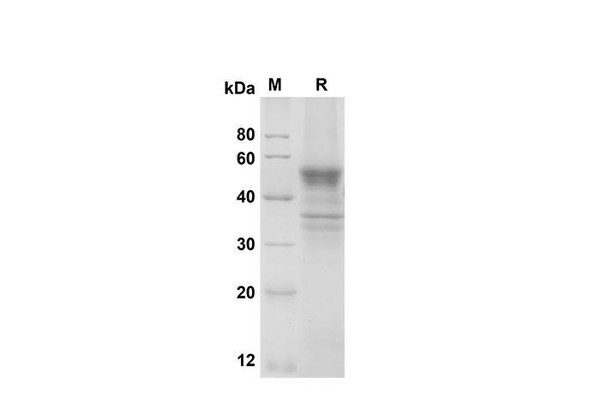 Recombinant Mouse LIGHT/TNFSF14 Protein (Fc Tag) (RPES8459)