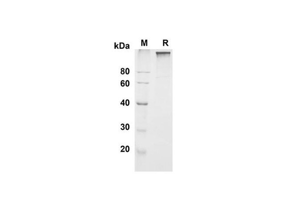 Recombinant Mouse Leptin R Protein (Fc Tag) (RPES8463)