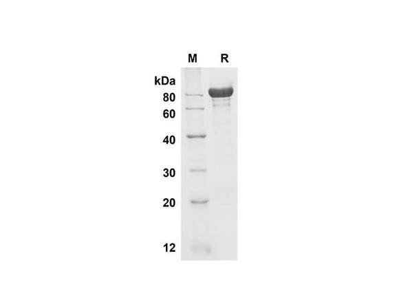 Recombinant Mouse Fetuin B Protein (Fc Tag) (RPES8467)