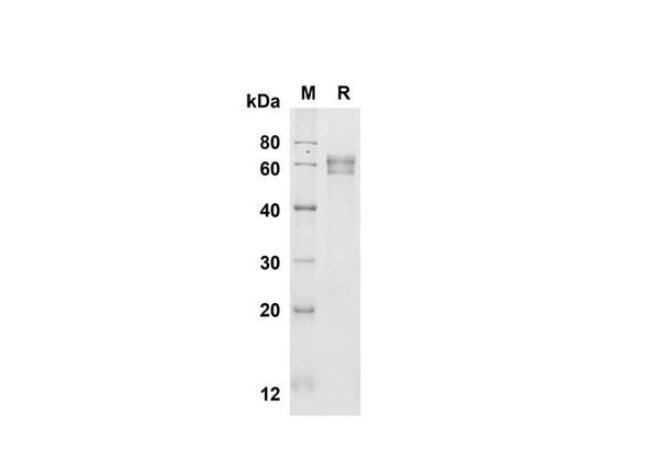Recombinant Mouse Fetuin B Protein (His Tag) (RPES8468)