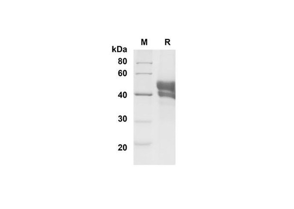 Recombinant Mouse CD27 Ligand/TNFSF7 Protein (Fc Tag) (RPES8470)