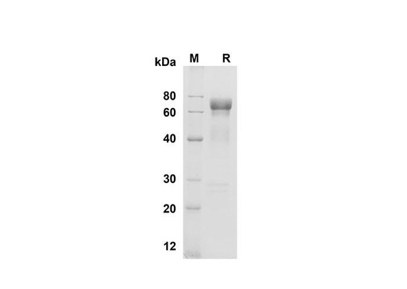 Recombinant Mouse Cathepsin B Protein (Fc Tag) (RPES8472)