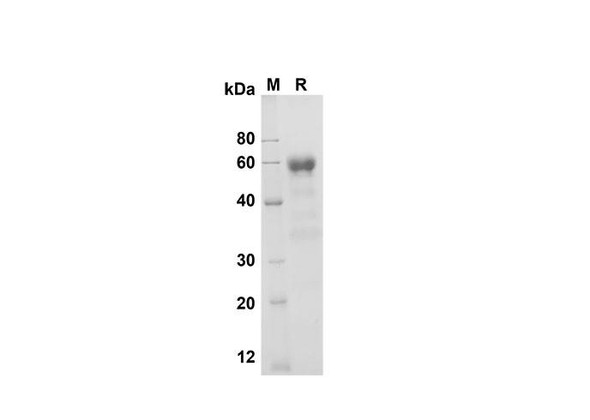 Recombinant Mouse CD27/TNFRSF7 Protein (Fc Tag) (RPES8477)