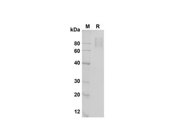 Recombinant Mouse IL-17 RA/IL-17 R Protein (Fc Tag) (RPES8480)