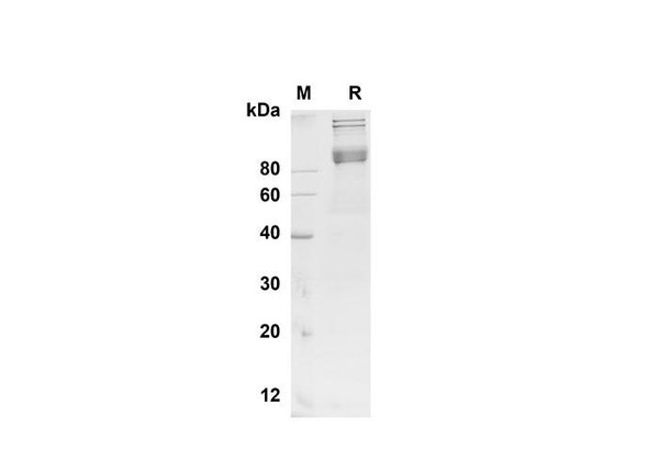 Recombinant Mouse BCAM Protein (Fc Tag) (RPES8486)