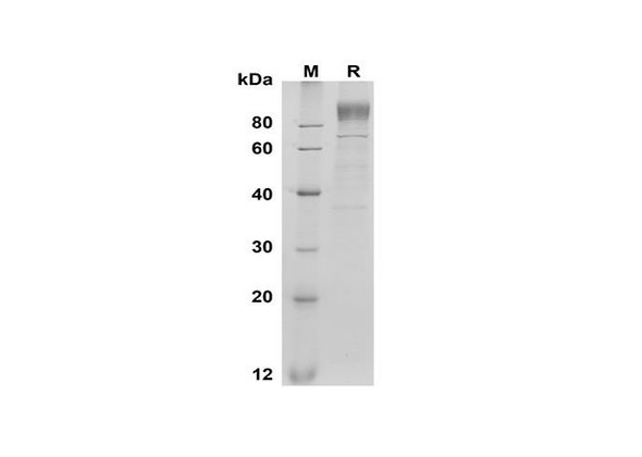 Recombinant Mouse G-CSF R/CD114 Protein (His Tag) (RPES8502)