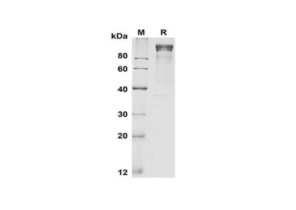 Recombinant Mouse G-CSF R/CD114 Protein (Fc Tag) (RPES8503)