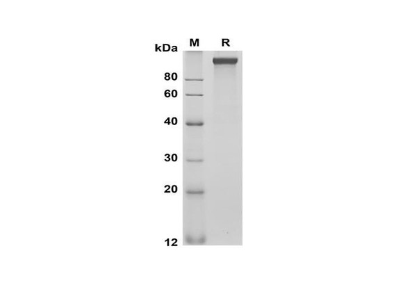 Recombinant Mouse Cd163 Protein (His Tag) (RPES8509)