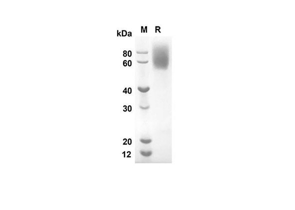 Recombinant Rat sCD86 Protein (FC Tag) (RPES8517)