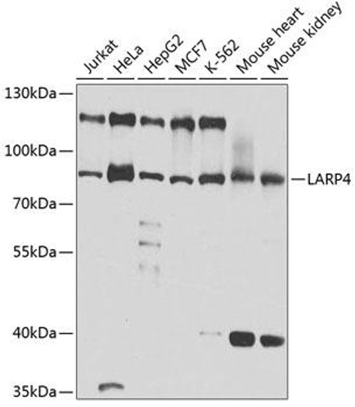 Anti-LARP4 Antibody (CAB5108)